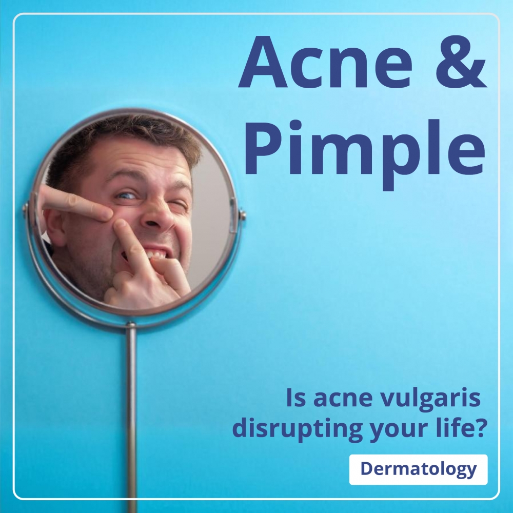 Acne or Pimples